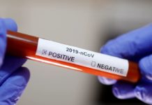 Itabaianinha registra o terceiro caso de coronavírus (COVID-19). Veja o vídeo