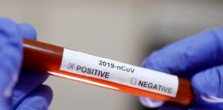 Itabaianinha registra o terceiro caso de coronavírus (COVID-19). Veja o vídeo