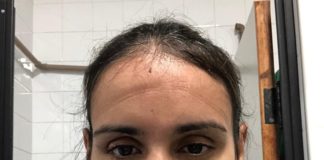 Médicos chegam a trabalhar 14 horas para atender pacientes com Covid-19 no CE; ‘Não pode ir ao banheiro’, diz voluntária