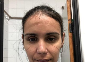 Médicos chegam a trabalhar 14 horas para atender pacientes com Covid-19 no CE; ‘Não pode ir ao banheiro’, diz voluntária