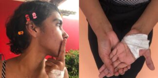 Universitária é agredida por grupo de vizinhos em Manaus após ouvir comentários racistas: ‘Essa negra tem que morrer’, escutou