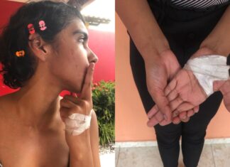 Universitária é agredida por grupo de vizinhos em Manaus após ouvir comentários racistas: ‘Essa negra tem que morrer’, escutou