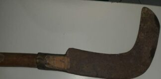 Mulher é golpeada com foice pelo companheiro em Monte Alegre