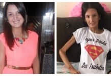 Jovem que chegou a pesar 34 kg por causa de doença rara morre após 8 anos de luta