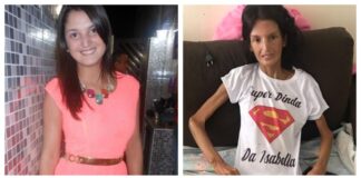 Jovem que chegou a pesar 34 kg por causa de doença rara morre após 8 anos de luta