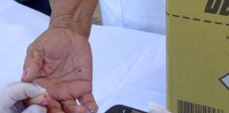 82 óbitos por Covid no Estado tinham diabetes entre as comorbidades