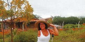 Tobiense precisa de ajuda para comprar uma perna mecânica