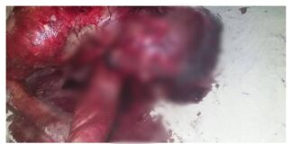 Urgente: triplo homicídio é registrado no Bairro Riacho Doce, em Itabaiana na noite desta sexta-feira, 16