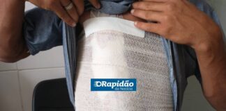 Adolescente de 15 anos agride namorado com garrafada na Zona Rural de Tobias Barreto