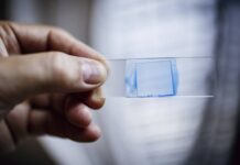 Superfungo identificado pela 1ª vez no Brasil mata 39% dos contaminados