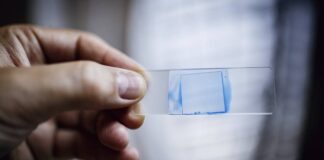 Superfungo identificado pela 1ª vez no Brasil mata 39% dos contaminados