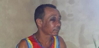 Homem não empresta dinheiro e é agredido por vizinho em Itabaianinha