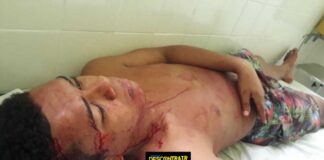 Jovem é agredido no povoado Sambaíba em Itapicuru – BA.
