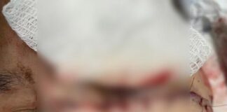 Jovem trans é agredido com golpes de facão