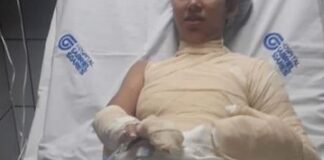 Mulher grávida de seis meses é queimada viva e sofre lesões em 60% do corpo